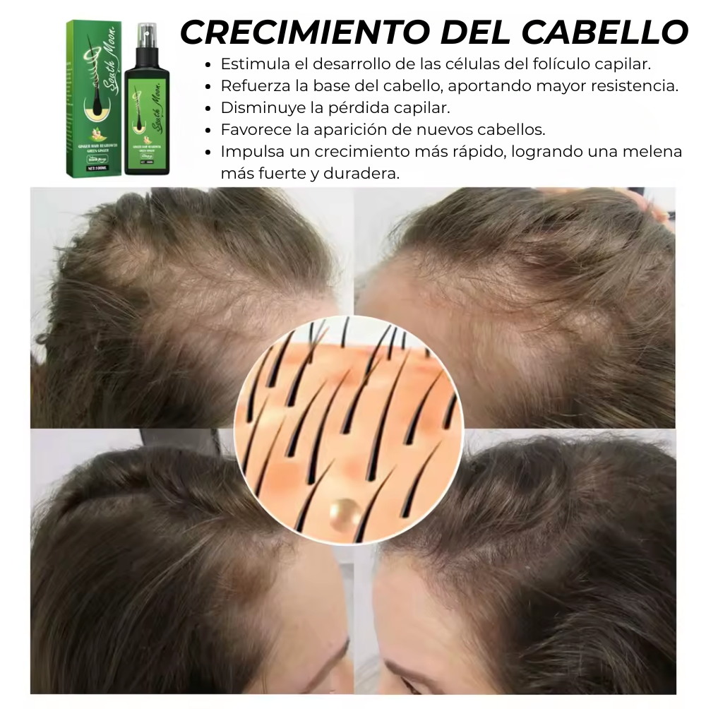 Pack Completo Cuidado Capilar – Spray + Suplemento HAIRCARE DUO 360°