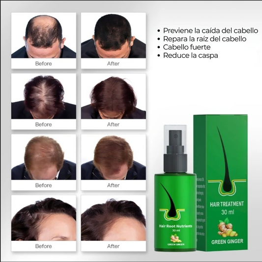 Pack Completo Cuidado Capilar – Spray + Suplemento HAIRCARE DUO 360°